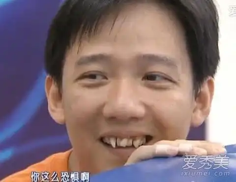 阿牛"牙龄最难看的明星"非阿牛莫属,形状怪异的牙齿,让身材矮小的阿牛
