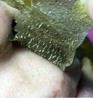 黑头粉刺巨恐怖怎么办?