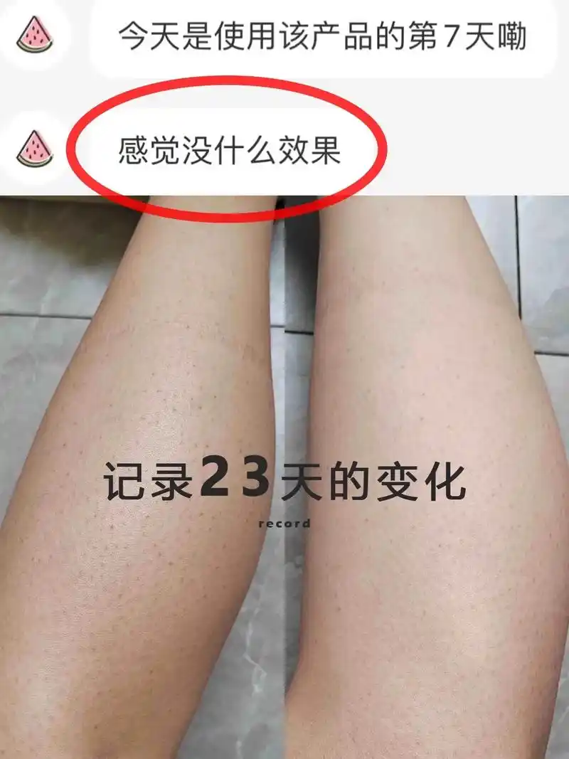 开始看着只是有鸡皮肤毛孔堵塞和发黑的色沉, - 抖音