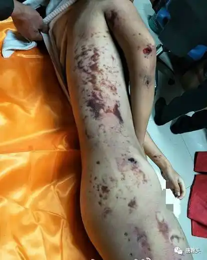 【又一起】震惊!高校一女大学生裸体坠楼身亡,尸体满身伤痕淤青