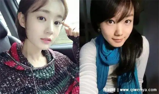 1,李一桐整容呀对比前后就能够很明显的发现,现在和以前的照片是有