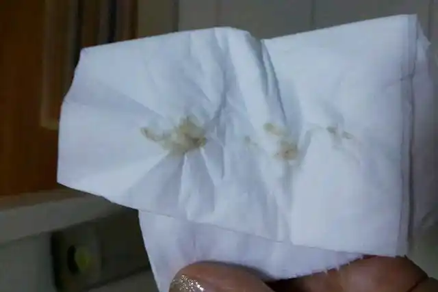 原创孕期的女性内裤经常潮潮的内裤有这种分泌物要重视起来