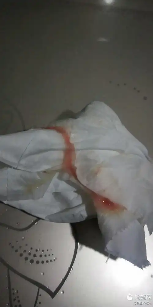 38 6晚上起夜白带带血,腰像来大姨妈一样酸疼,是_妈妈网孕育社区_妈妈