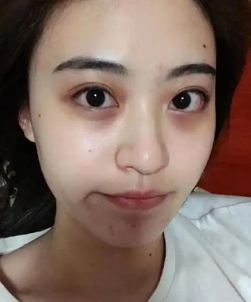 虽然说很想早睡早起,但是一不留神就会熬夜,但是熬夜对女生皮肤的影响