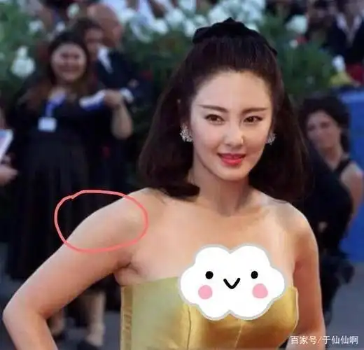 被称为"气质杀手"的斜方肌到底有多可怕?来看看赵露思的逆袭吧