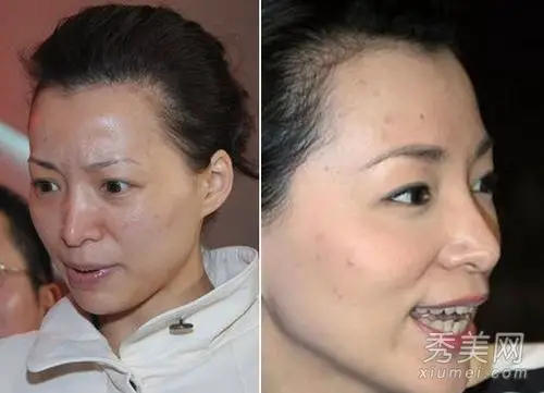 邓紫棋戚薇 最丑素颜女星top 8(1/11)