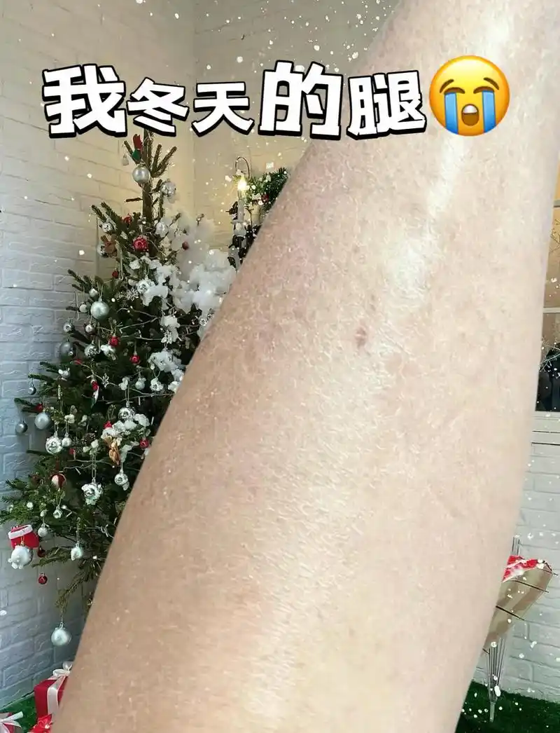 我的腿干燥又粗糙!这个蛇油简直是糙皮救星!滑 - 抖音