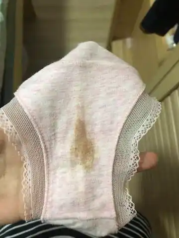 大家不要觉得恶心啊,这个是褐色分泌物吗?是说明有出血吗?