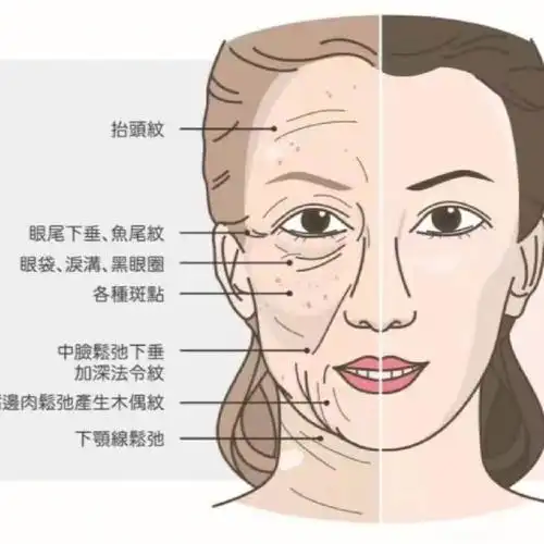 皮肤从外到内有很多层次,我们就由外而内说明[一r]皮肤变薄老化过程中