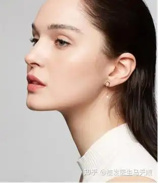 什么发际线形状最好看? - 知乎