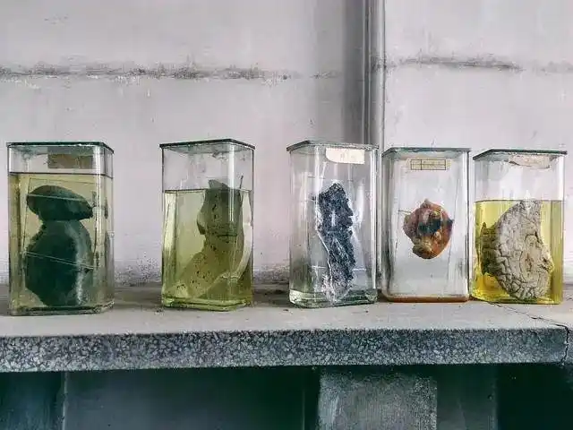 尸体|福尔马林|废弃建筑_网易订阅