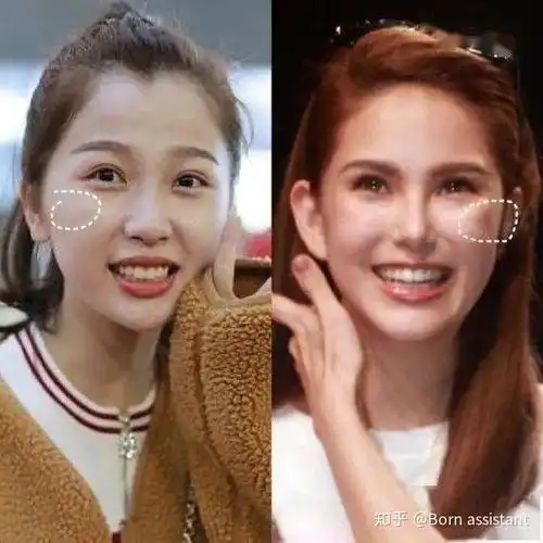 这个窝跟酒窝梨窝可不一样!拥有显老10岁