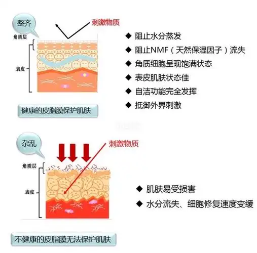 皮脂膜是由皮肤分泌的油脂和汗腺分泌的汗液经乳化后在皮肤表面形成一