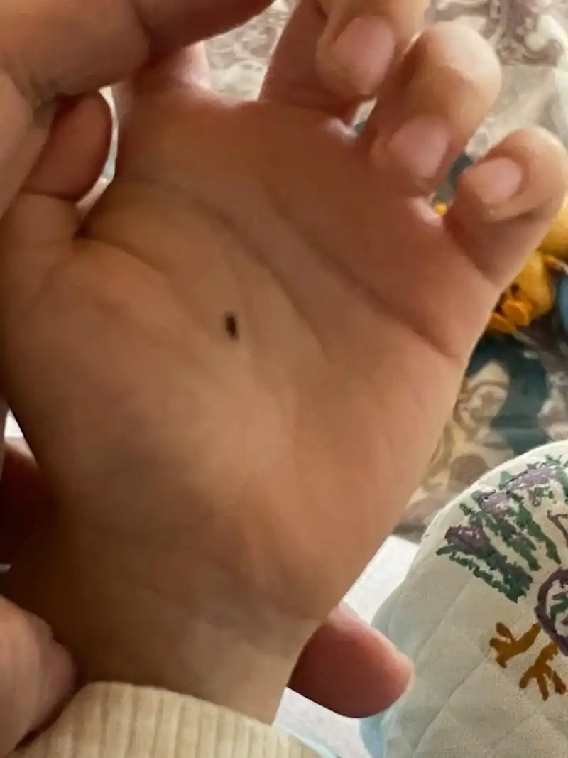 掌心痣 小朋友你左手掌心的痣是那么的明显呀!