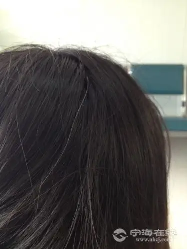 白头发"拔一根长十根"?自己的头发,心里没数吗?