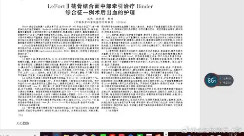 赖皮蛇功课之面中凹陷伴突嘴——binder综合征