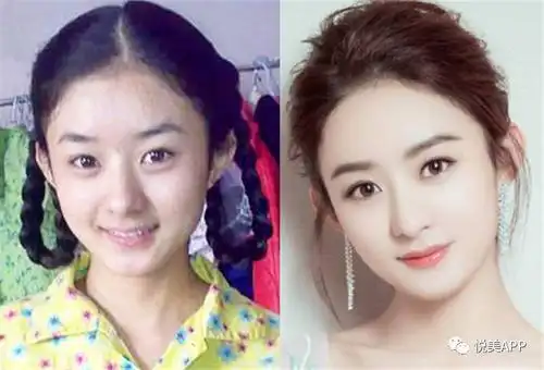 杨幂发际线快上天试与唐嫣肩并肩但她们为何不植发捏