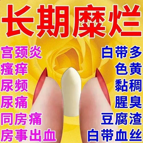 消糜栓正牌官方旗舰店阴道瘙痒治疗宫颈糜烂的药阴道炎妇科用药mj