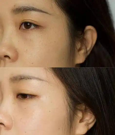 美白界模范生来了,淡斑亮白,让你气色好起来!_olay_小白_产品