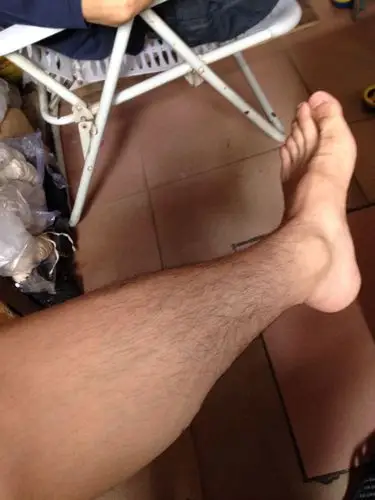 大学男生,腿毛略多…直接穿短裤合适吗