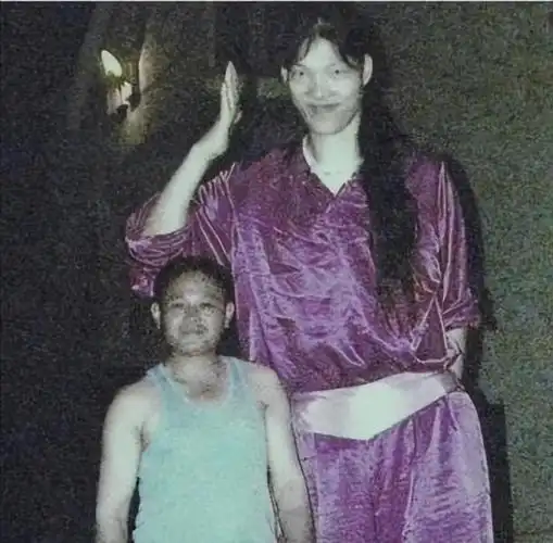 回顾:安徽"女巨人"姚德芬,穿78码的鞋子,一顿饭吃六碗