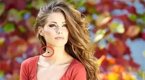 脖子上长痣面相好吗 脖子上长痣好不好