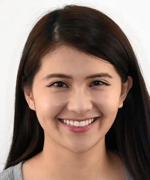 你的笑容完美吗? 关於牙齿的微笑曲线