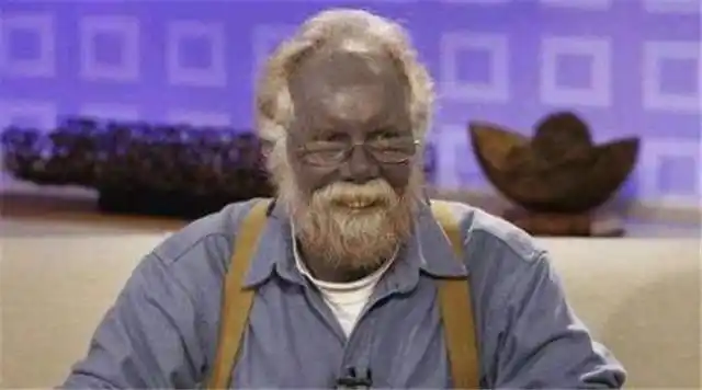 世界上绿种人不足3000,血是绿色的,他们只靠光合作用能活下去么