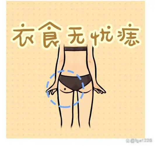 腿上长痣代表什么?腿上长痣的含义