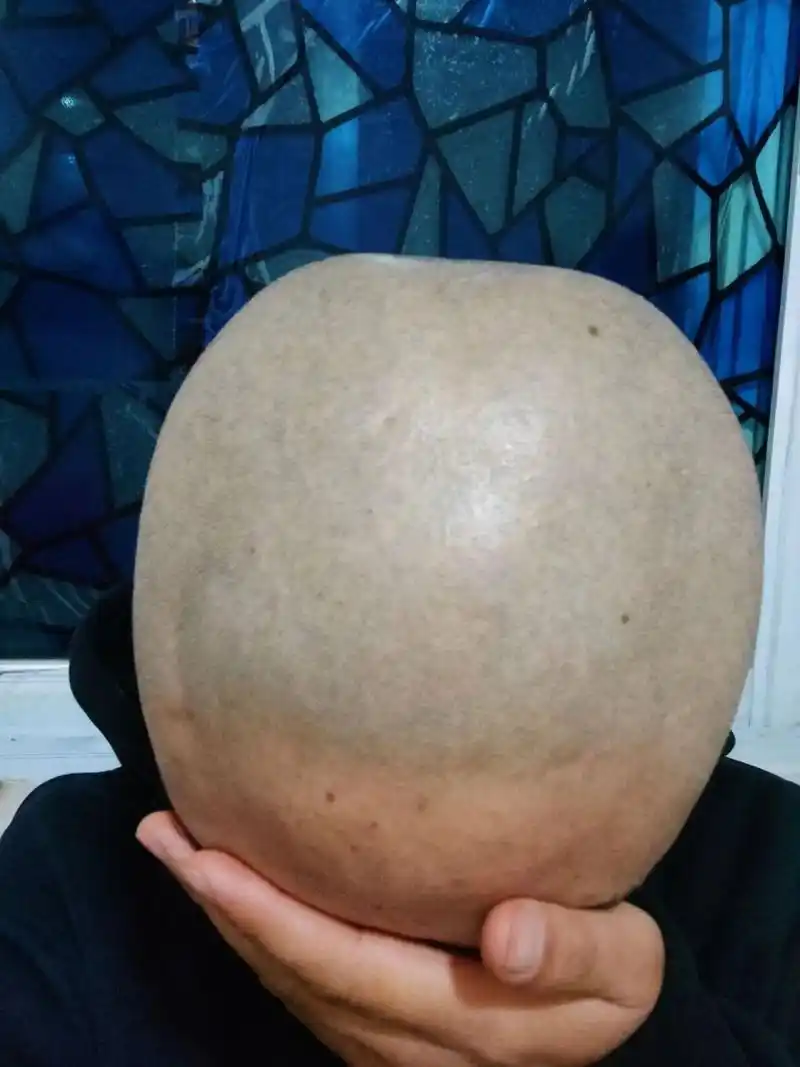 左滑看光头三个月能长多长  距离最后一次剃光头马上就三个月啦,中间