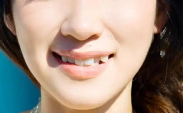 矫正虎牙会改变脸型吗矫正虎牙能改变脸型吗图