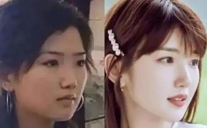 36岁的毛晓彤,终于为自己的"整容"付出了代价