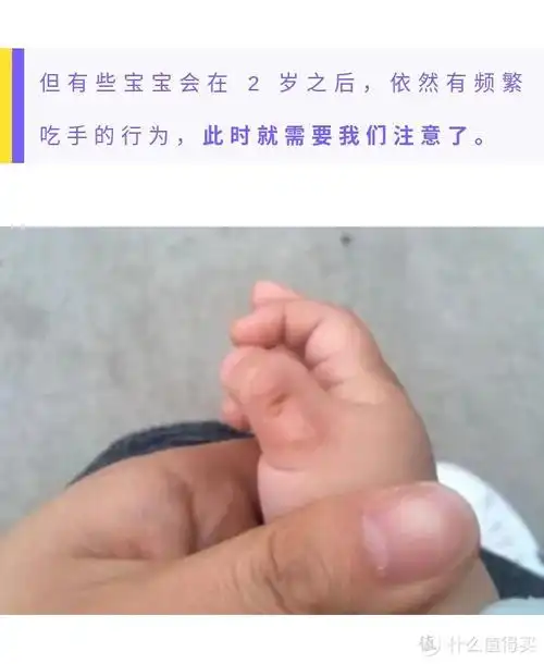 暴力制止bb吃手背后隐藏的风险你不得而知