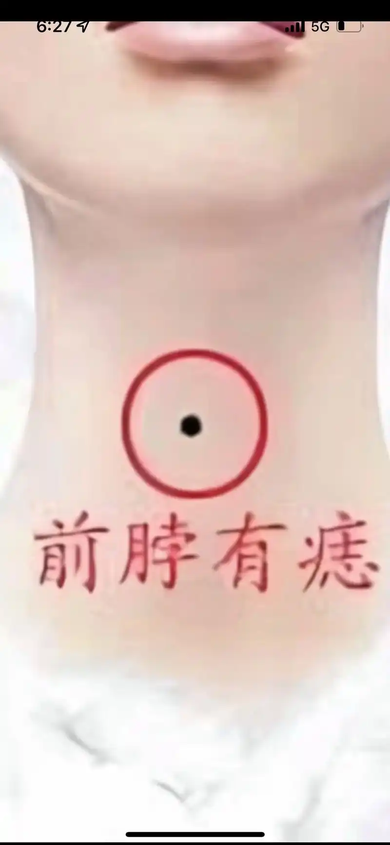 脖子上有痣,兄弟不合,爱情不利,脖子前面有痣,是为招小人,容易被陷害