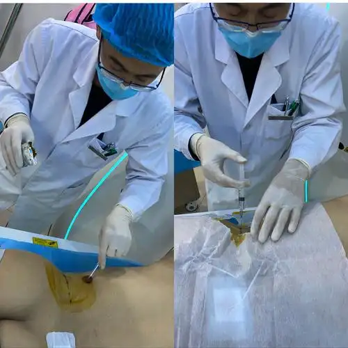 通辽市医院西院影像科ct引导下穿刺活检 今日完成"一患两穿" - 美篇