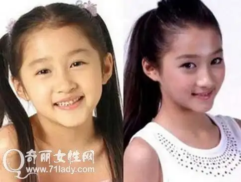 关晓彤晒长腿街拍 关晓彤整容前后照片差别不大(2)