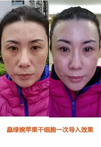 皮肤干燥的原因