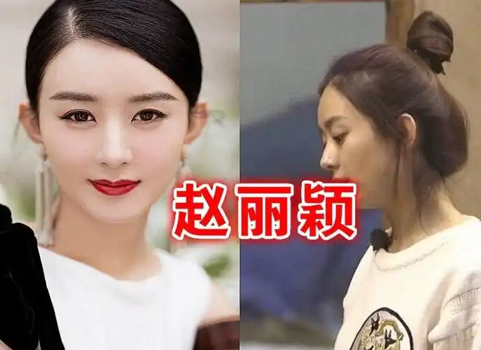 卸妆后的赵丽颖照片她素颜满脸痤疮真的假的