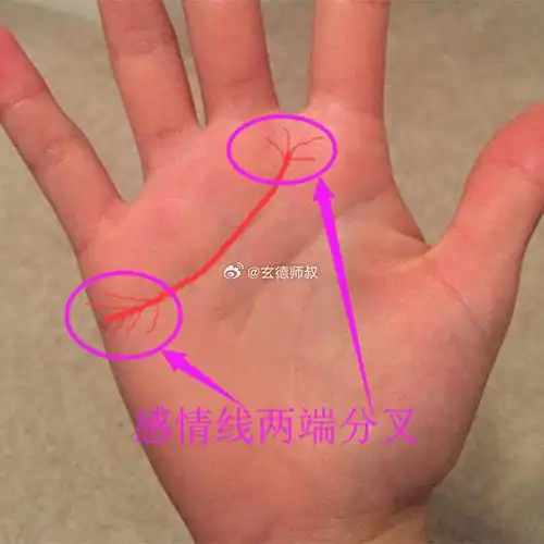 感情线分叉为两支,是情感发展和婚姻不吉利的象征.
