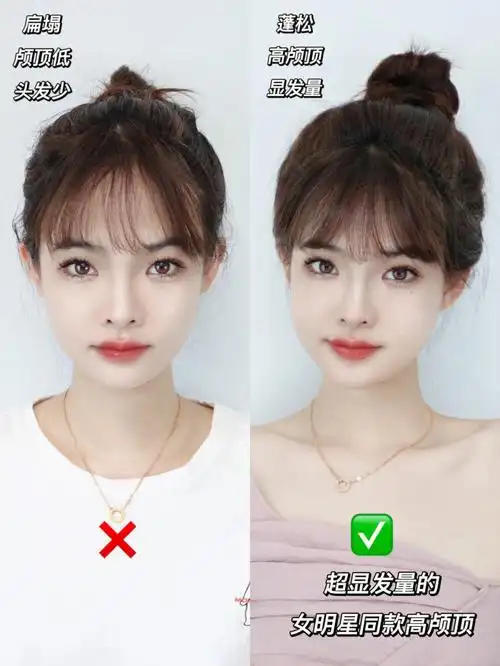 高颅顶magic|细软发也能有头发空气感9599