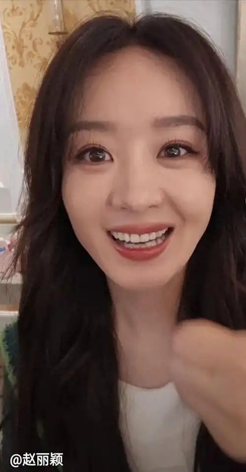 赵丽颖最新动态引热议嘴歪脸僵牙齿白是过度医美还是整容了