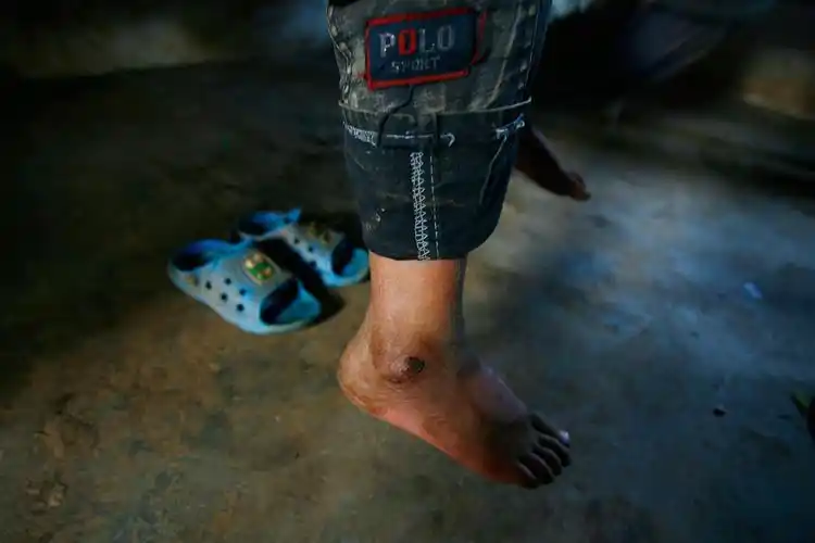 很多同学没有鞋子穿,冬天还穿着夏天的塑料凉鞋,光着脚在教室里窜