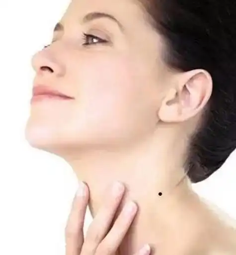 女生脖子左侧有痣好吗 哪里有痣命运会好