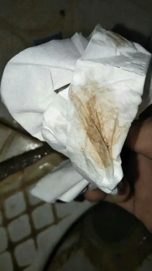 同房几天后发现内裤有几滴血,什么情况