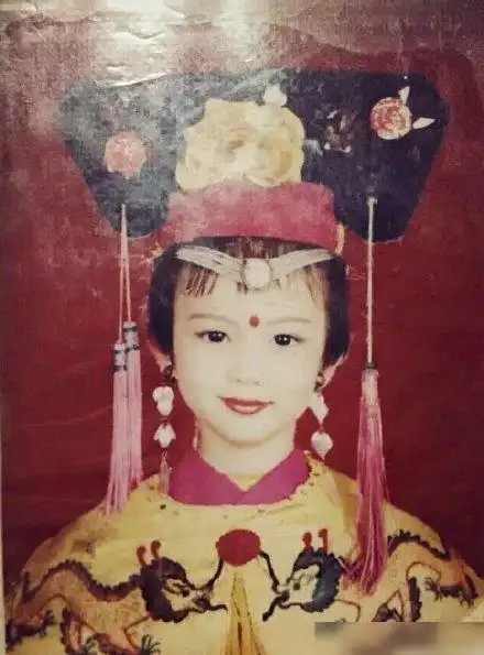 金晨直播被质疑歪嘴,晒童年照怒刚网友,表示自己就喜欢这样!