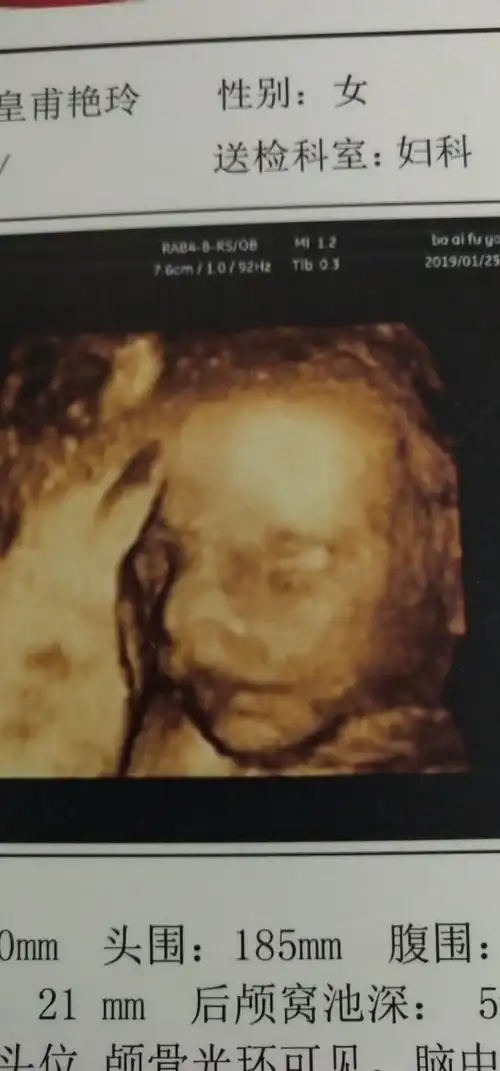 愉快!四维彩超图片"龟龙麟凤"-第2张图片-凯飞博客