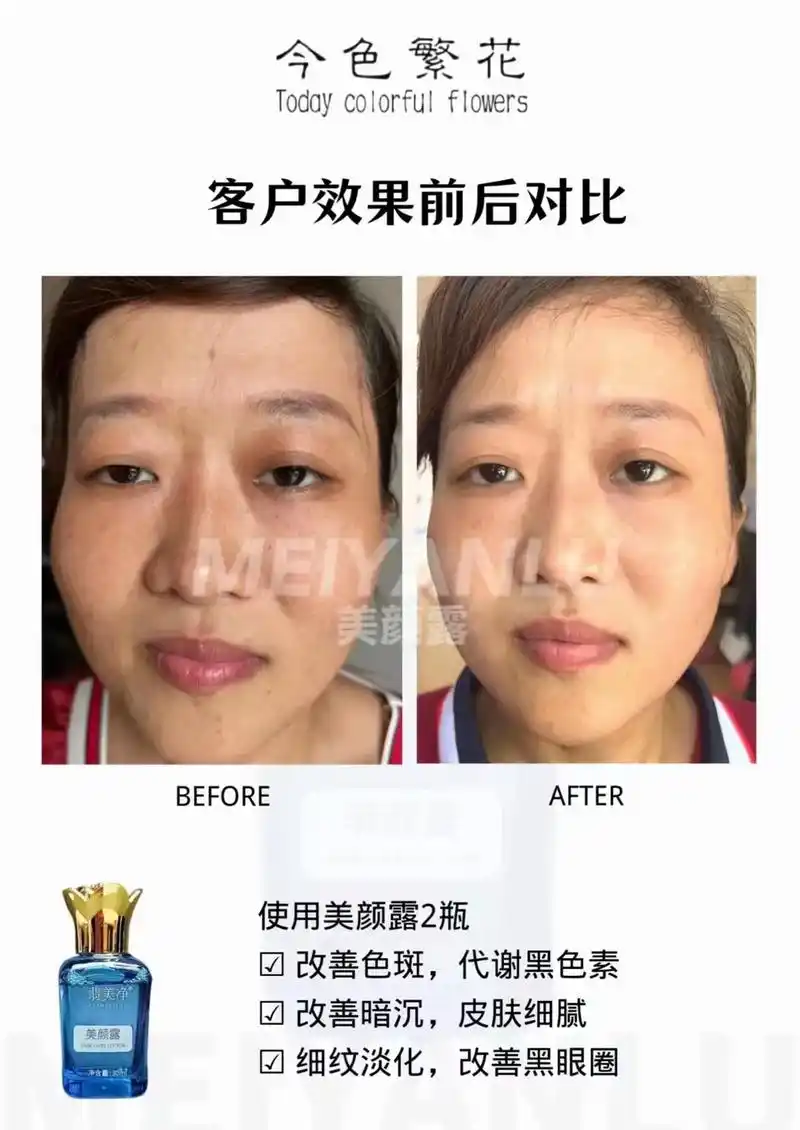 改善暗沉,皮肤细腻 √改善色斑,代谢黑色素 客户效果前后对比 - 抖音