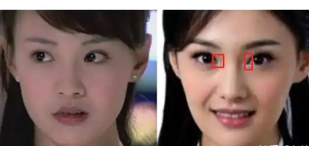 郑爽整容前后对比照片