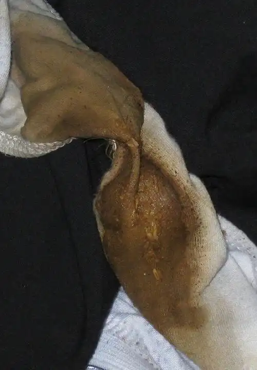 一个月不换内裤