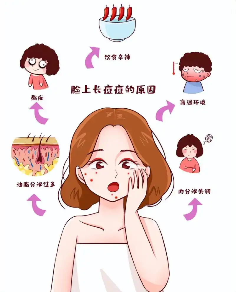 痘痘,闭口为什么总找上你?真相原来如此简单